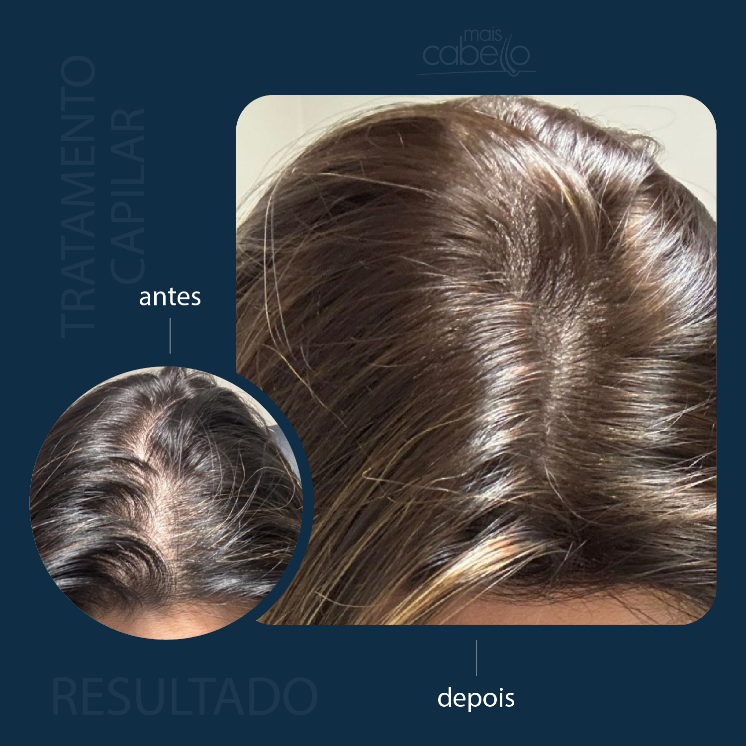 Antes e Depois - Recuperação de Densidade